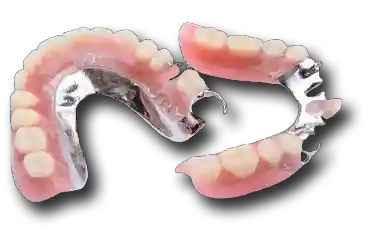 Shettleston Smile Dental Practice Glasgow NHS and Private Treatment Dentures Cobalt Chrome Partial