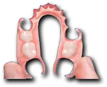 Shettleston Smile Dental Practice Glasgow NHS and Private Treatment Dentures Flexible Partial