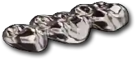 Shettleston Smile NHS Dentist Metal Bridge