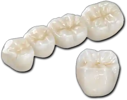 Shettleston Smile NHS Dentist Zirconia crowns