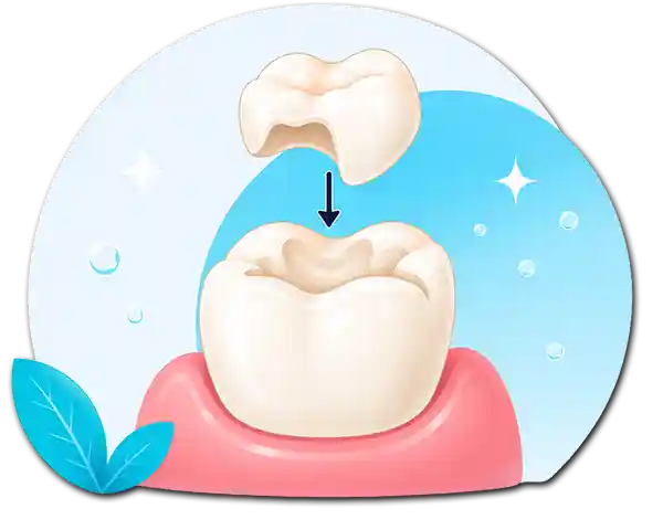 Shettleston Smile Tooth Restoration